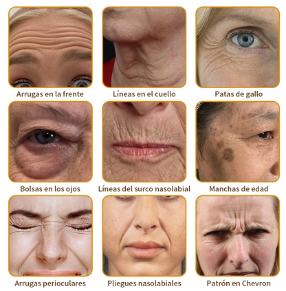 🎄¡Promo de temporada! La crema reafirmante Healrize® con 40% de descuento por tiempo limitado. Úsala diario y en 7 días notarás la diferencia: ayuda a reducir la apariencia de arrugas y flacidez.🐝✨