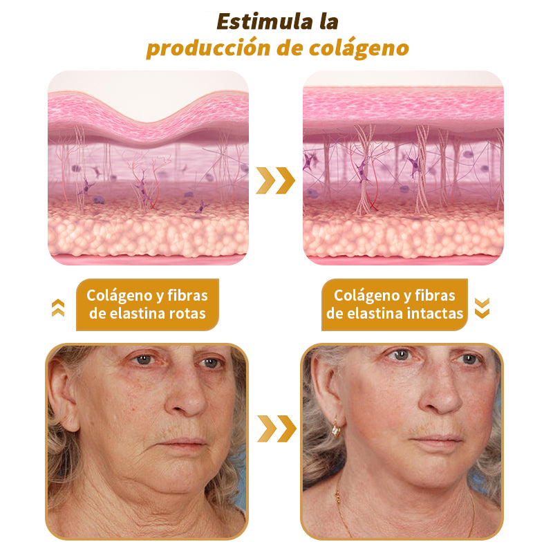 🎄¡Promo de temporada! La crema reafirmante Healrize® con 40% de descuento por tiempo limitado. Úsala diario y en 7 días notarás la diferencia: ayuda a reducir la apariencia de arrugas y flacidez.🐝✨