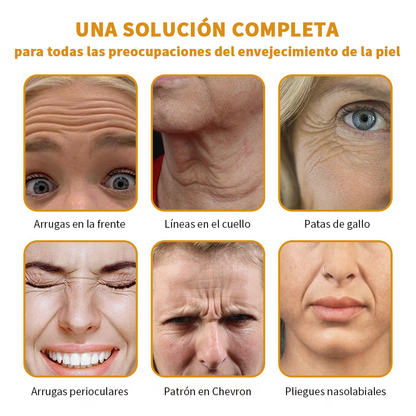 🎄¡Promo de temporada! La crema reafirmante Healrize® con 40% de descuento por tiempo limitado. Úsala diario y en 7 días notarás la diferencia: ayuda a reducir la apariencia de arrugas y flacidez.🐝✨
