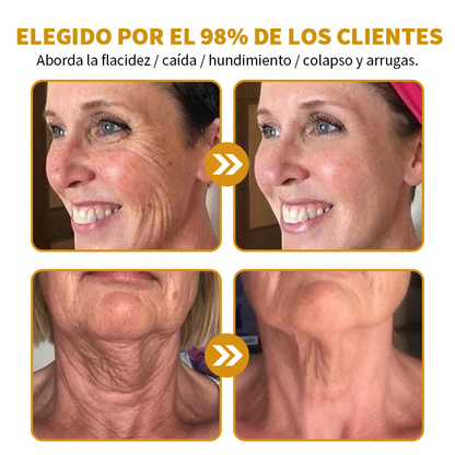🎄¡Promo de temporada! La crema reafirmante Healrize® con 40% de descuento por tiempo limitado. Úsala diario y en 7 días notarás la diferencia: ayuda a reducir la apariencia de arrugas y flacidez.🐝✨