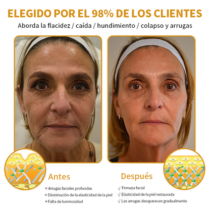 🎄¡Promo de temporada! La crema reafirmante Healrize® con 40% de descuento por tiempo limitado. Úsala diario y en 7 días notarás la diferencia: ayuda a reducir la apariencia de arrugas y flacidez.🐝✨